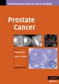Prostate Cancer: Book by Hedvig Hricak , Peter Scardino