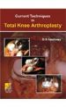 Current Techniques in Total Knee Arthoplasty: Book by G. S. Sawhney