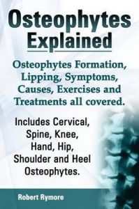 Osteophytes Explained. Osteophytes Formation, Lipping, Symptoms, Causes, Exercises and Treatments All Covered. Includes Cervical, Spine, Knee, Hand, Hip, Shoulder and Heel Osteophytes.: Book by Robert Rymore