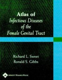 Atlas of Infectious Diseases of the Female Genital Tract: Book by Richard L. Sweet Atlas of Infectious Diseases of the Female Genital Tract: Book by Richard L. Sweet