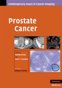 Prostate Cancer: Book by Hedvig Hricak , Peter Scardino Prostate Cancer: Book by Hedvig Hricak , Peter Scardino