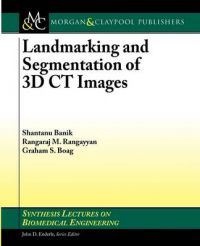 Landmarking and Segmentation of 3D CT Images: Book by Shantanu Banik