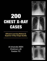 200 Chest X-Ray Cases: Book by Mudher Al-khairalla