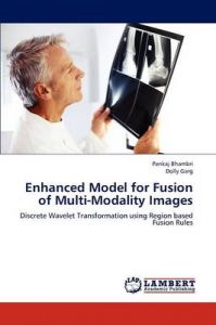 Enhanced Model for Fusion of Multi-Modality Images: Book by Pankaj Bhambri